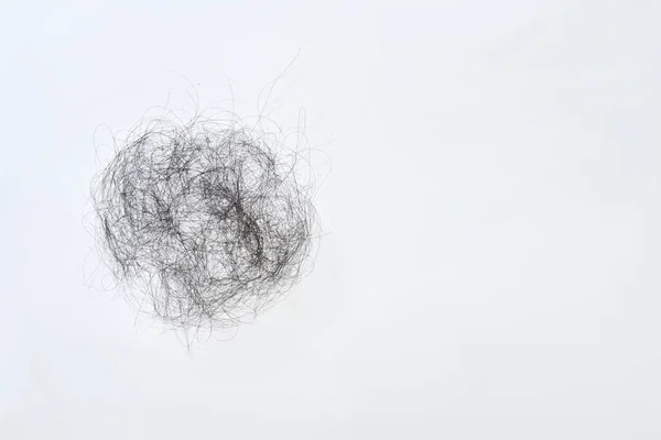 Saç Dökülme Sorunları Çok Fazla — Stok fotoğraf