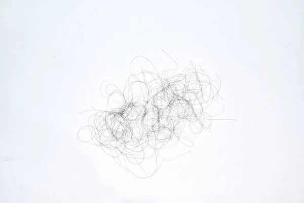 Saç dökülme sorunları çok fazla.