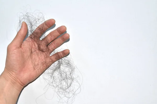 Saç dökülme sorunları çok fazla.