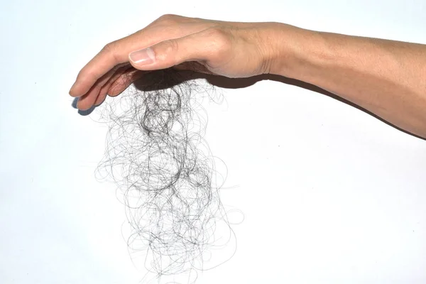 Saç dökülme sorunları çok fazla.