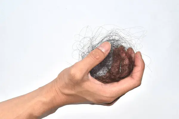 Saç dökülme sorunları çok fazla.