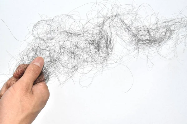 Saç dökülme sorunları çok fazla.