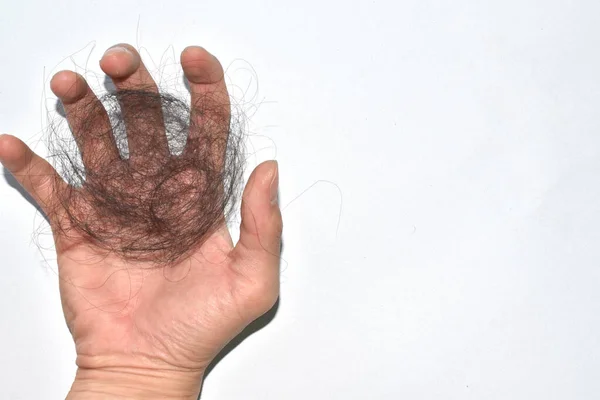 Saç dökülme sorunları çok fazla.