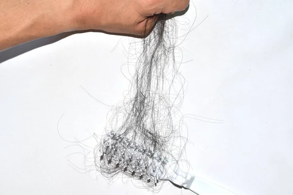 Saç dökülme sorunları çok fazla.