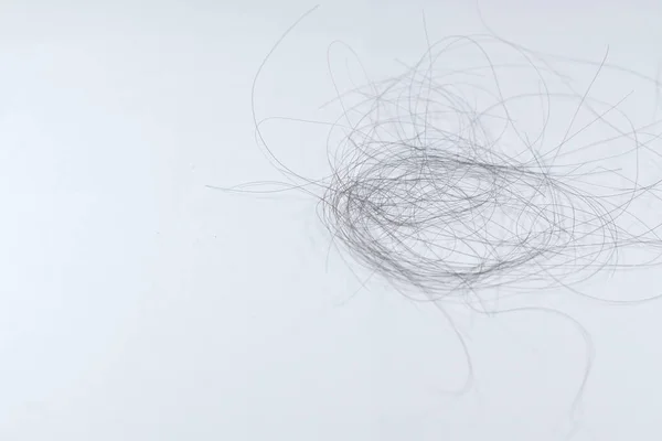 Saç dökülme sorunları çok fazla.