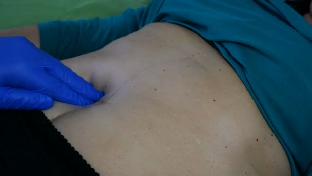 Le médecin palpe à la main dans un gant de caoutchouc bleu estomac de la femme malade qui est couché dans son lit. Gros plan . — Video