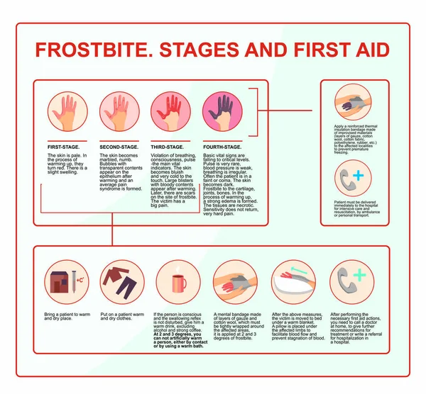 Frostbite Příznaky Ochrana Léčba Infografická Ilustrace Vektoru První Pomoc Při — Stockový vektor