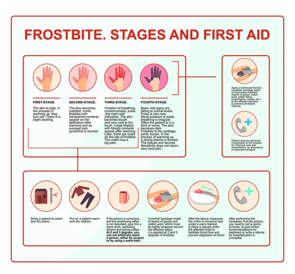 Congelamento Sintomi Protezione Trattamento Illustrazione Infografica Vettore Pronto Soccorso Durante — Vettoriale Stock