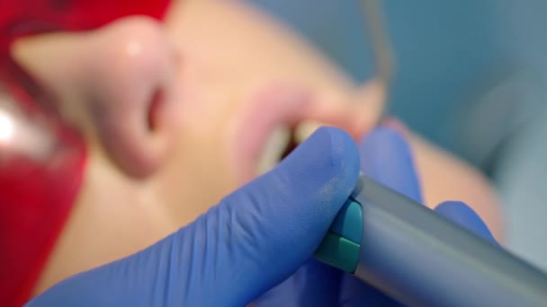 Dentiste Traitant Patient Avec Équipement Spécial — Video