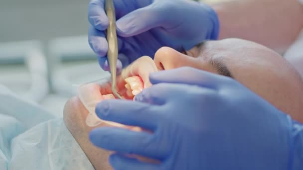 Dentista Examinando Los Dientes Pacientes — Vídeos de Stock