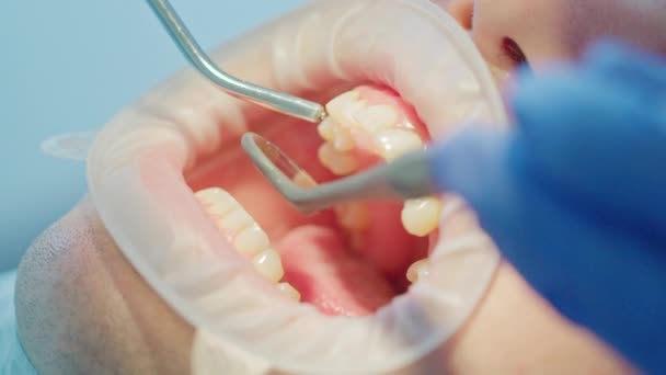 Tandläkare Undersöker Patienter Tänder — Stockvideo