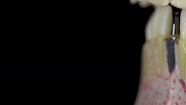 Dental Model Human Skull Black Background — Stock Video