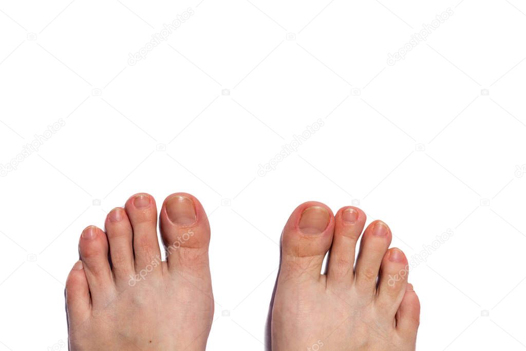 female toes without pedicure. nail salon. nail salon. spa salon.