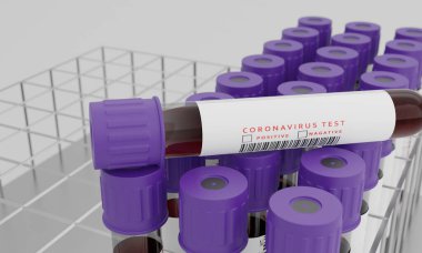 Beyaz arka planda kan ve koronavirüs testi etiketli test tüpleri var. Corona virüsünü test etme konsepti. 3B Hazırlama.