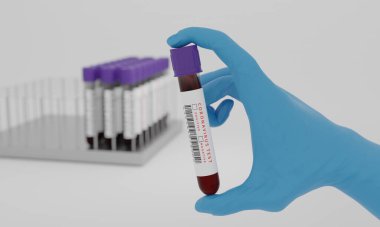 Beyaz arka planda kan ve koronavirüs testi etiketli test tüpleri var. Corona virüsünü test etme konsepti. 3B Hazırlama.
