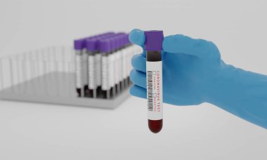 Beyaz arka planda kan ve koronavirüs testi etiketli test tüpleri var. Corona virüsünü test etme konsepti. 3B Hazırlama.