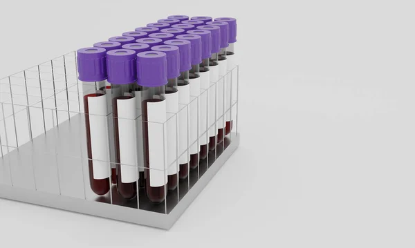 Vérrel Fehér Alapon Izolált Üres Címkével Ellátott Kémcsövek Koronavírus Vizsgálatának — Stock Fotó