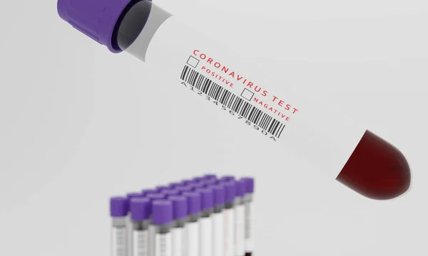 Testbuisjes Met Bloed Coronavirus Test Label Geïsoleerd Witte Achtergrond Concept — Stockfoto