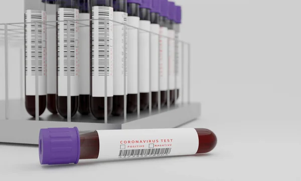 Test tubes with blood and coronavirus test label  isolated on white background. Concept for testing corona virus. 3D Rendering.
