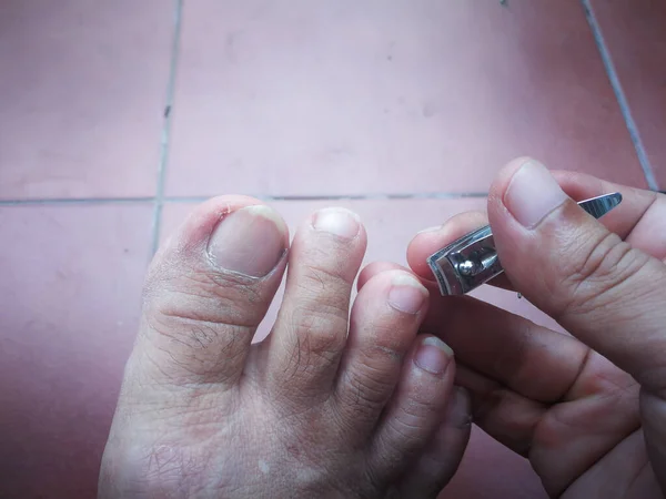 Hombre Cortar Las Uñas Los Pies Pedicura Pie Sucio Por — Foto de Stock