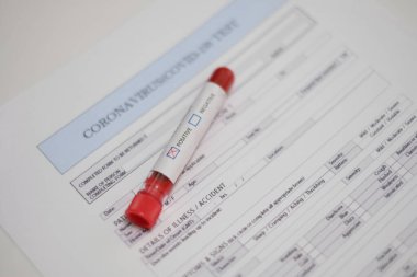 Coronavirus 2019 nCoV Kan Testi. Test tüpü ve örnek koronavirüs test formum. Negatif ve pozitif sonuç.