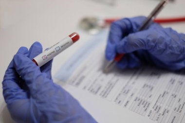Coronavirus 2019-nCoV Kan Testi. Corona virüsü. Çin virüsü. Coronavirus testi. El, içinde test tüpü olan bir hasta numunesi tutuyor. Test sonuçlarım pozitif çıktı..