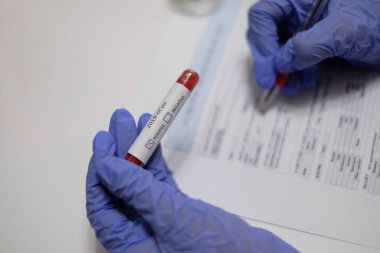 Coronavirus 2019-nCoV Kan Testi. Corona virüsü. Çin virüsü. Coronavirus testi. El, içinde test tüpü olan bir hasta numunesi tutuyor. Test sonuçlarım pozitif çıktı..