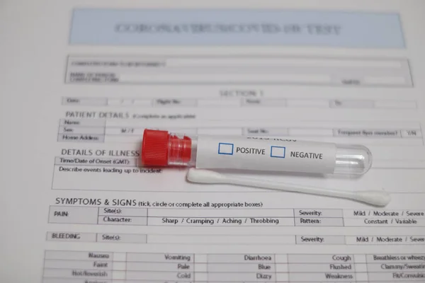 コロナウイルス2019 Ncv血液検査 検査管とサンプルのコロナウイルス検査フォーム 負の結果と正の結果 — ストック写真