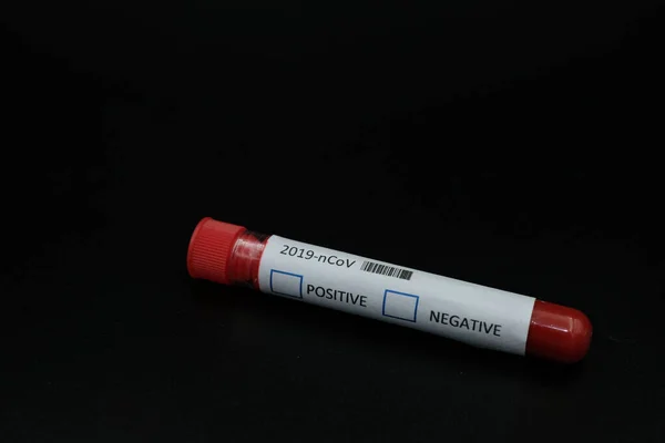 Zestaw Testów Koronawirusowych Czarnym Tle Próbka Laboratoryjna Badań Krwi Celu — Zdjęcie stockowe