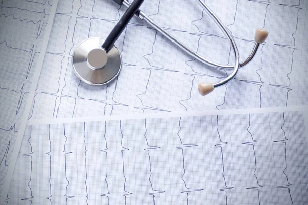 Cardiograma Con Estetoscopio Pluma Lupa Pastillas Vasos Puestos Una Mesa — Foto de Stock