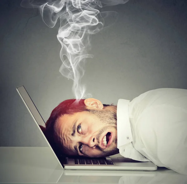 Uomo dipendente stressato con cervello surriscaldato utilizzando il computer portatile — Foto Stock