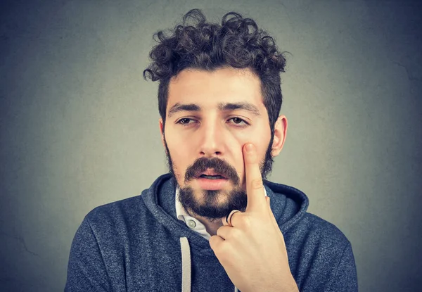 Hombre enfermo sufriendo después de la fiesta — Foto de Stock