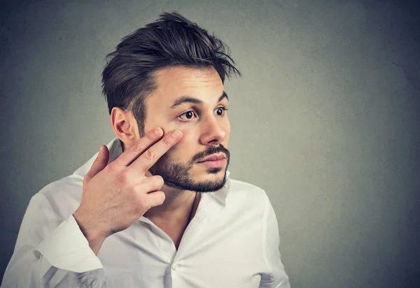 Mann, der das Augenlid herunterzieht und in den Spiegel schaut, fühlt sich unwohl — Stockfoto