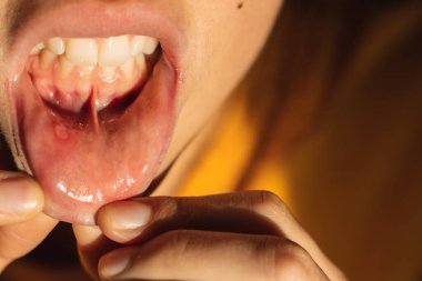 Dudağında aftalin olan kadını kapat.