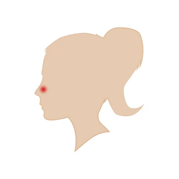 La silueta de la cabeza de una mujer. Goteo nasal. Vector . Ilustración De Stock