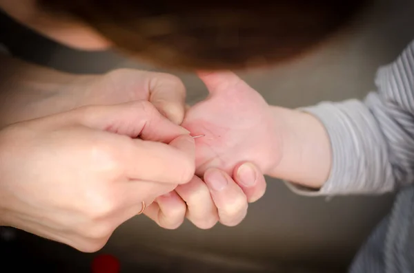 Splinter Hand Child Girl Pulls Splinter Hands Child — Stock Photo, Image