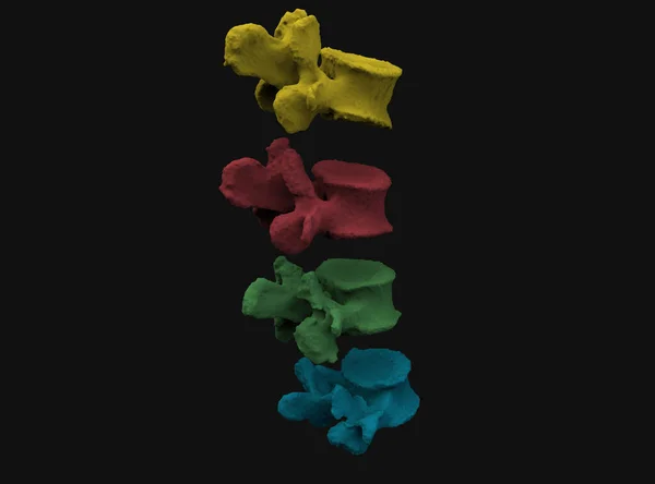 Model of human spine- vertebra on black background, 3D render — Stock Image Model Human Spine Vertebra Black Background Render Stock Photo