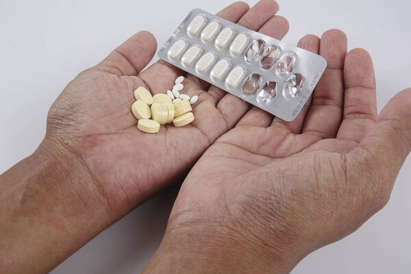 Man with dermatitis problem of rash ,Allergy rash