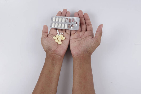 Man with dermatitis problem of rash ,Allergy rash