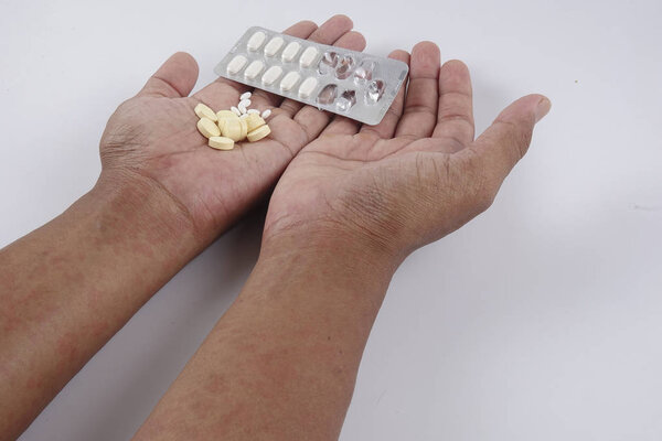 Man with dermatitis problem of rash ,Allergy rash