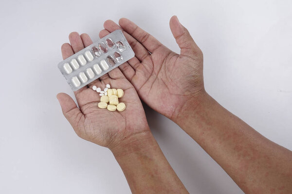 Man with dermatitis problem of rash ,Allergy rash