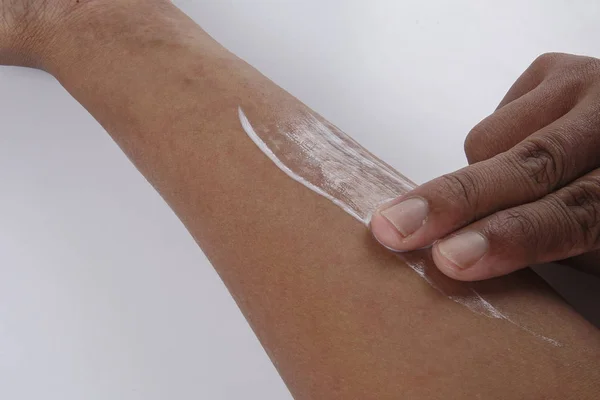 Döküntü, Anti döküntü Dermatit sorunu olan adam