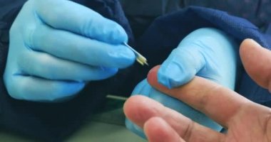 Kovid-19 için parmak kan testi. Eldivenli ellerin kan örneği alması. Kan testini kapat..