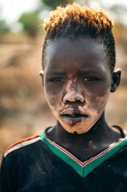 MUNDARI TRIBE, Güney Sudan, Afrika 'da güneşli bir günde Mundari Kabile Köyü' nde yaşarken yüzünde ve tişörtünde ayin lekesi olan genç çocuk kameraya bakıyor.