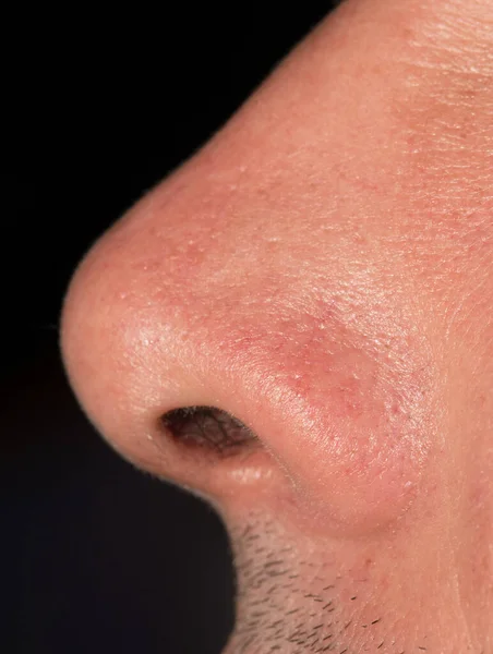 Hidung Pria Pada Latar Belakang Hitam — Stok Foto