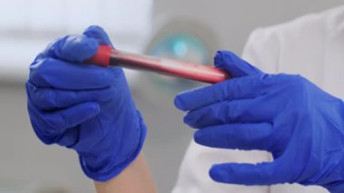 Coronavirus kan testiyle ellerini kapat. Laboratuvarda iki eliyle koruyucu eldiven giyen bir doktor kan tüpü takıyor. Salgın, salgın, ilaç kavramı