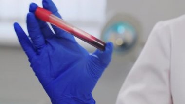 Coronavirus kan testi. Koruyucu eldiven giyen bir doktor, laboratuarda kan örneğiyle tüpü sallıyor. Eller yukarı. Salgın, salgın, ilaç kavramı