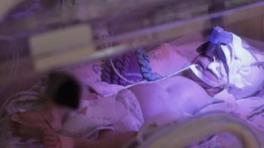 Yeni doğan çocuklar için yoğun bakım. Bebek bacaklarına, ellerine ve kafasına bağlı kuvöz sensörleri. Yüzün bir kısmı tüp ve kapakla kapatılmış. Beslenmek için ağzında tüp olan bebek..