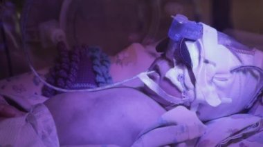 Hastanedeki kuvözde yeni doğmuş bebeğe yakın çekim yap. Bebek hareket ediyor ve nefes alıyor. Ağza bir beslenme tüpü bağlanmış. Yüzün yarısı bir kapak ve bir tüple kapalı..