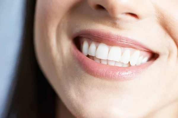 Zbliżenie kobiety piękne zęby i piękny uśmiech — Zdjęcie stockowe
